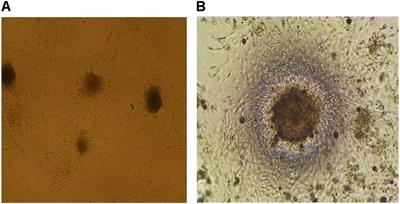 Toxic Effects of Trichloroethylene on Rat Neuroprogenitor Cells